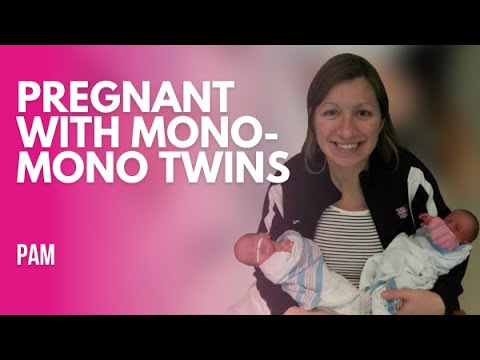 Pregnant with Mono-mono twins | Part 1 - YouTube