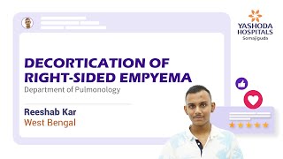 Decortication of Right-Sided Empyema | Yashoda Hospitals Hyderabad |