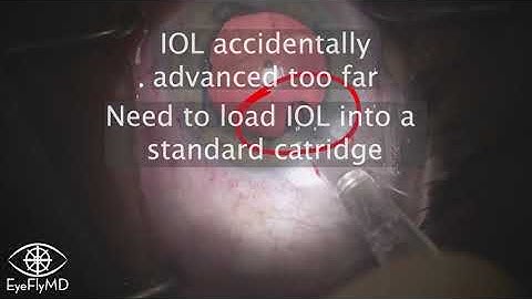 Quickly Reloading a Preloaded IOL