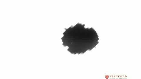 Image-based localization with DMLC tracking for Intensity Mo