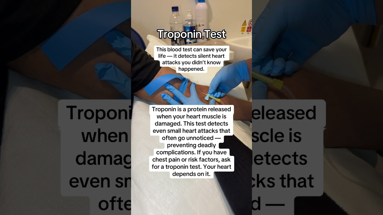 Silent heart attacks are dangerous. Troponin tests help catch them early. #HeartHealth #TroponinTest