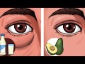 6 Foods That Can Give You Puffy Eyes and 4 That Can Fix Them!!