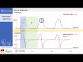 Principios de Ventilacion Mecanica Introduccion