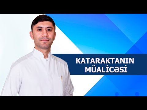 Video: Kataraktın Cərrahiyyə ilə Müalicəsinin 3 Yolu