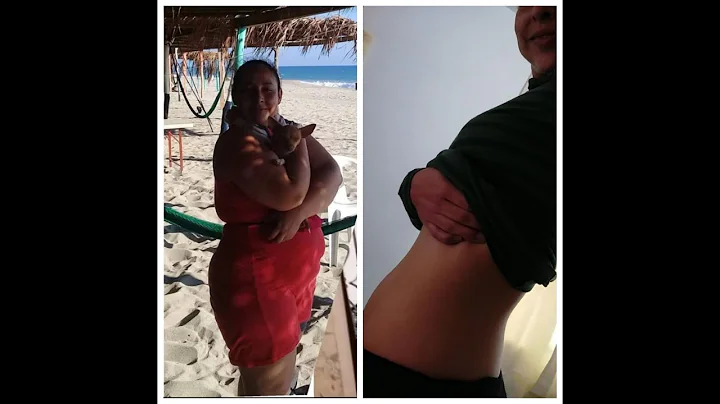 Julia improved her life on a carnivore diet