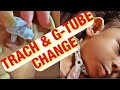 CHANGING BABYS TRACH & G-TUBE | FULL DETAIL|