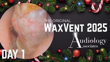 25 minuten keratosis obturans extractie - Waxvent dag 1