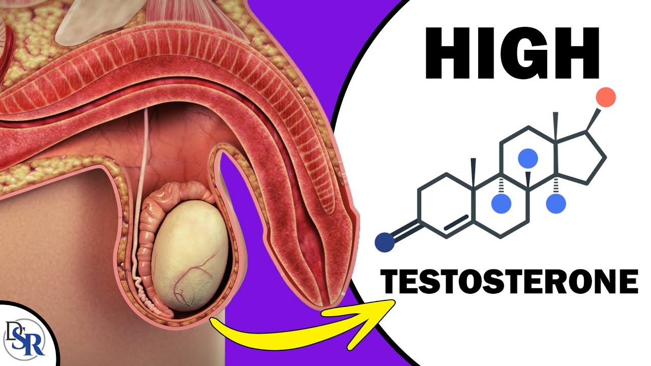 Does The Size Of Your Testicles Affect 𝐓𝐞𝐬𝐭𝐨𝐬𝐭𝐞𝐫𝐨𝐧𝐞  𝐋𝐞𝐯𝐞𝐥𝐬 - YouTube
