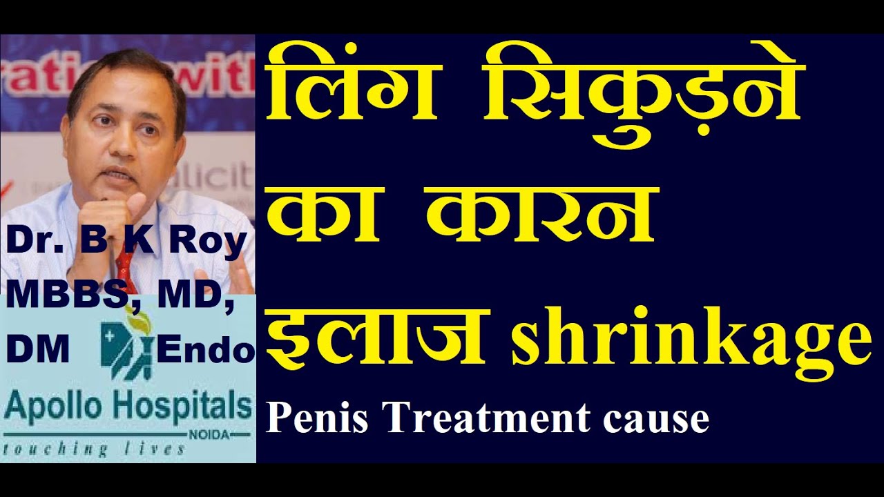 Siikuda Ling Hone ka ilaj Ling Shrink Hone ka karan ilaj Shrinkage