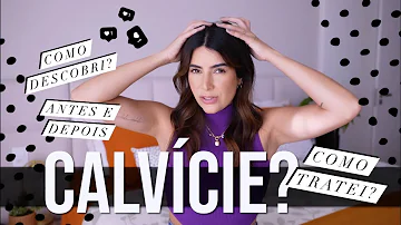 Por que ocorre a calvície?