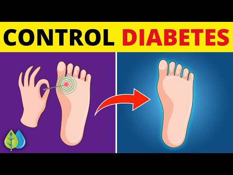 Top 10 Foods to Control Diabetes