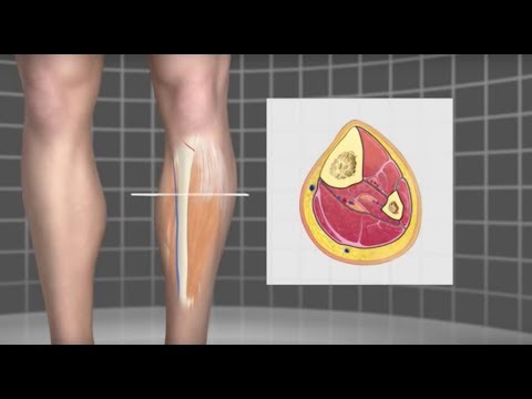 Runner's Compartment Syndrome Mayo Clinic