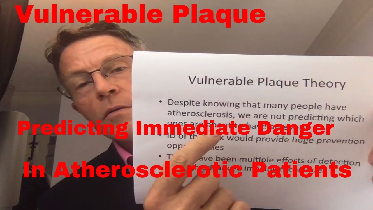 The Vulnerable Plaque Theory: Can We Predict When a Plaque Will Blow?