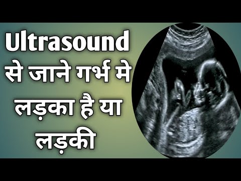 Ultrasound se kaise pta kre ki baby boy h kya baby girl | Ultrasound ...
