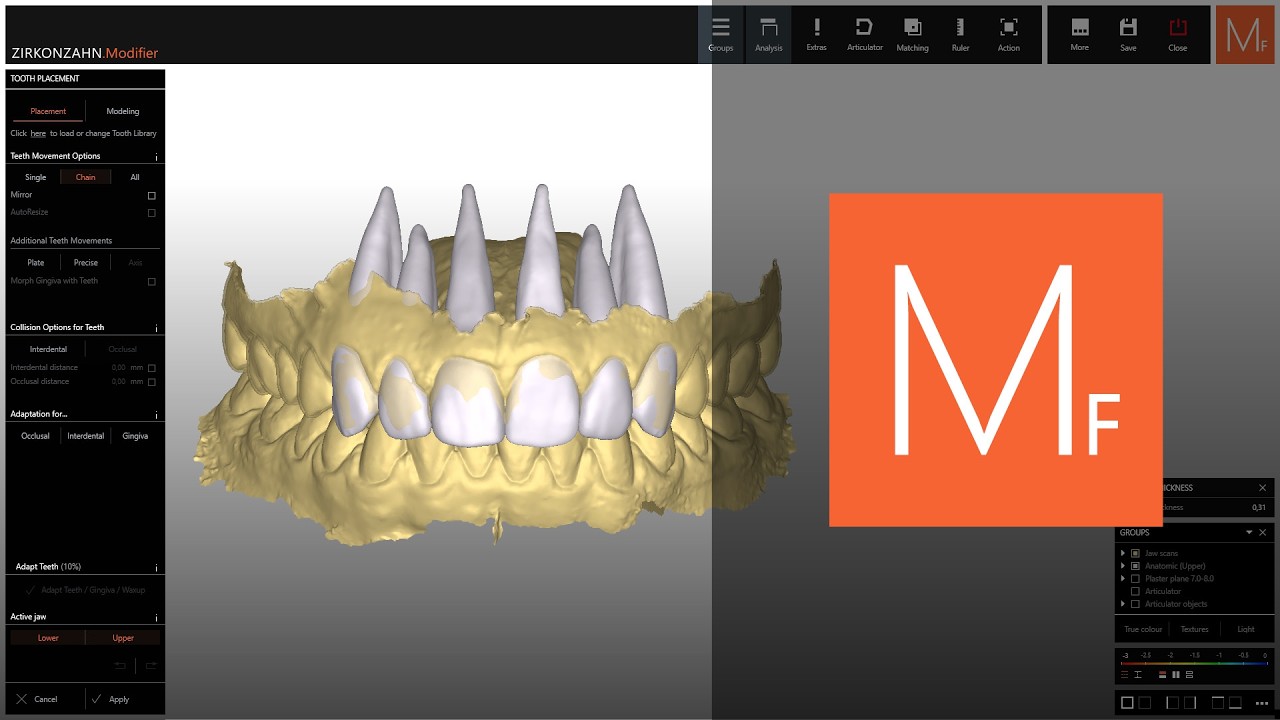 Tooth Setup & Minimal Thickness | Zirkonzahn.Modifier