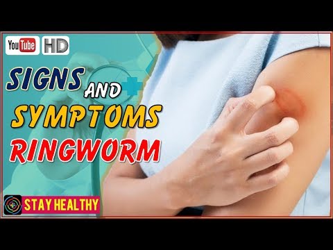 10 Signs and Symptoms of Ringworm