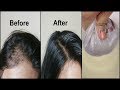 Make your thin hair to thick and long hair fast/magical hair growth home remedy