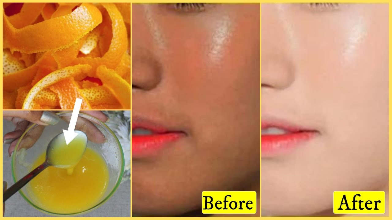 Приготовьте эту осветляющую и отбеливающую сыворотку для кожи из апельсиновой цедры – преобразите...