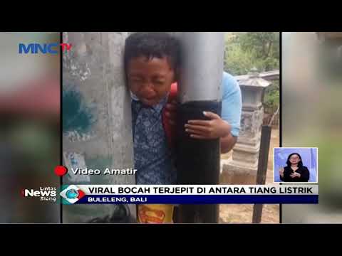 Viral! Kepala Bocah