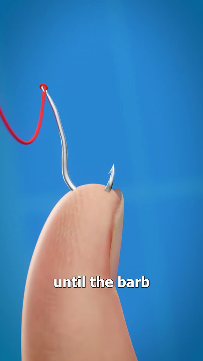 How To Remove A Fishhook 😱