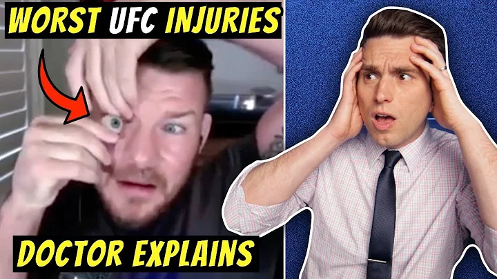 Worst UFC Injuries EVER! Doctor Explains SHOCKING ...
