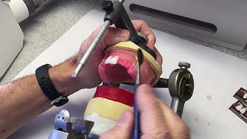 Maxillary anterior denture tooth setup for trial