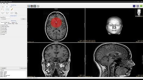 Analyze 14.0 - Measure: 2D Sample Ovals