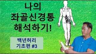 나의 좌골신경통 해석하기! (백년허리 기초편#3)