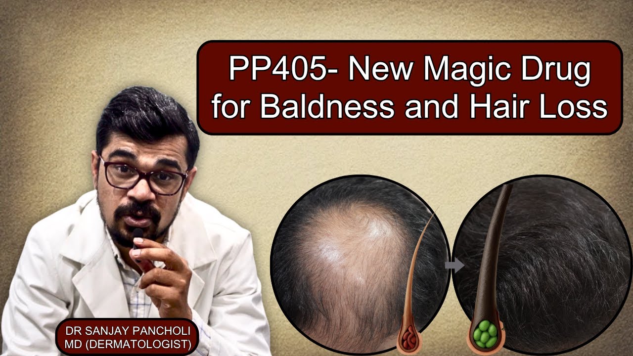 PP405- New Magic Drug for baldness and hair loss #hairtreatment - YouTube