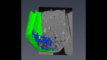 3D reconstruction of a prehistoric urn from CT scans