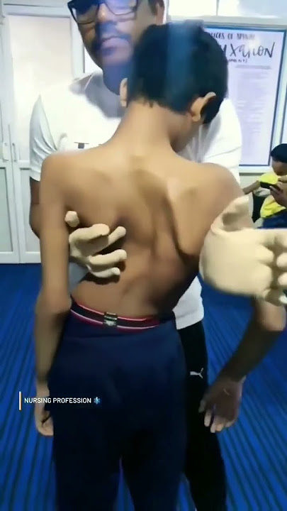 CHIROPRACTIC TULANG PUNGGUNG BENGKOK || DUNIA KEPERAWATAN