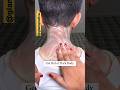 Get Rid Of Dark Neck, Knees, Elbow...  #shortsvideo  #youtubeshorts #shrts