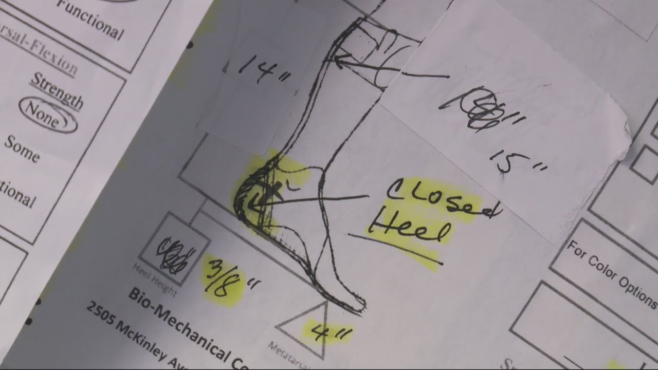 Metro company making leg braces and a difference every step of the way