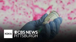 Political fight over measles leaves patients in the middle, doctors say