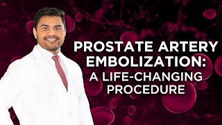 Life-Changing Experience: Prostate Artery Embolization W/ Dr. Ramkrishna Patel | Patient Testimonial