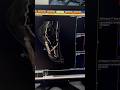 Ruptured Foot Artery on 3D CT Angiography #shorts