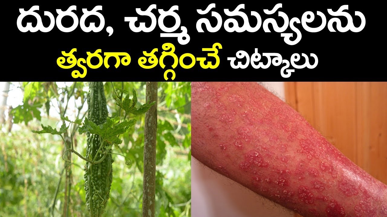 Best Health Tips For Skin ProblemsSkin Allergy Itching TreatmentSkin