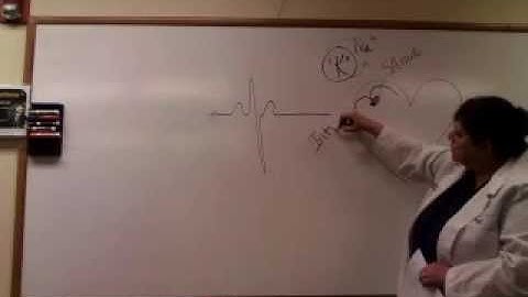 Basic Arrhythmia Part 1 Introduction