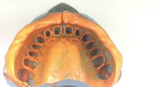 Final Impression | Dentistry screenshot 5