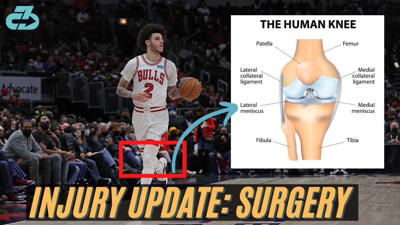 Lonzo Ball Injury Update: Expert Explains Knee Surgery, Timeline & Impact 