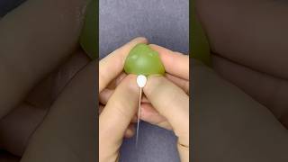 Inyección Squishy Correcta Écnica Édico