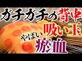 【吸い玉　ガチガチの体に長い鍼】痛い整体　原因はガチガチの体？首コリ？　鼻づまり・花粉症の原因は・・・【鍼　ブレア元町　ブレア銀座】