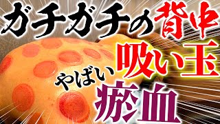 【吸い玉　ガチガチの体に長い鍼】痛い整体　原因はガチガチの体？首コリ？　鼻づまり・花粉症の原因は・・・【鍼　ブレア元町　ブレア銀座】