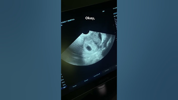 A star has arrived at Ingenes Aguascalientes. Join us to meet her ⭐️ #infertility #fertility