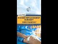 How Painful is the Surgery going to be? #kneereplacementoperation #kneesurgey #shorts #orthopaedic