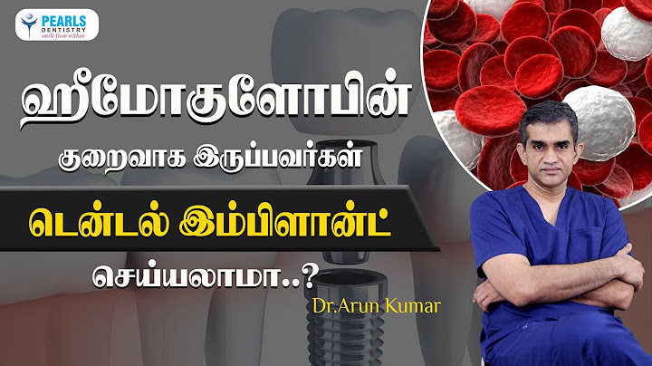 ஹீமோகுளோபின் குறைவாக இருப்பவர்கள் டென்டல்  இம்பிளான்ட் செய்யலாமா..? | Pearls Dentistry | Chennai