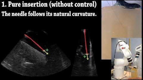3D ultrasound-guided robotic steering of a flexible needle via visual servoing