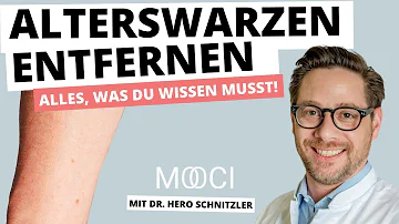 Kann ich Alterswarzen selber entfernen?