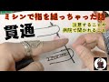 ミシン針で指を貫通しちゃった話！指を縫ってしまったらどうした良いの？応急処置や病院で聞かれることなど。