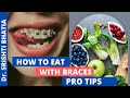 How to eat with braces? ब्रेसेस लगाए हुए खाना कैसे खाएं? Dr. Srishti Bhatia